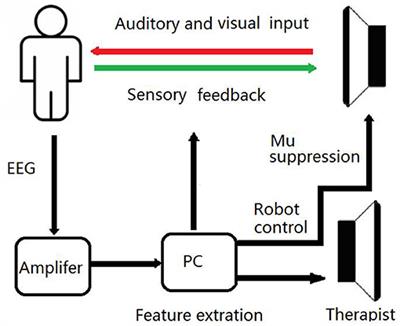 Brain Functional Networks Study of Subacute Stroke Patients With Upper Limb Dysfunction After Comprehensive Rehabilitation Including BCI Training